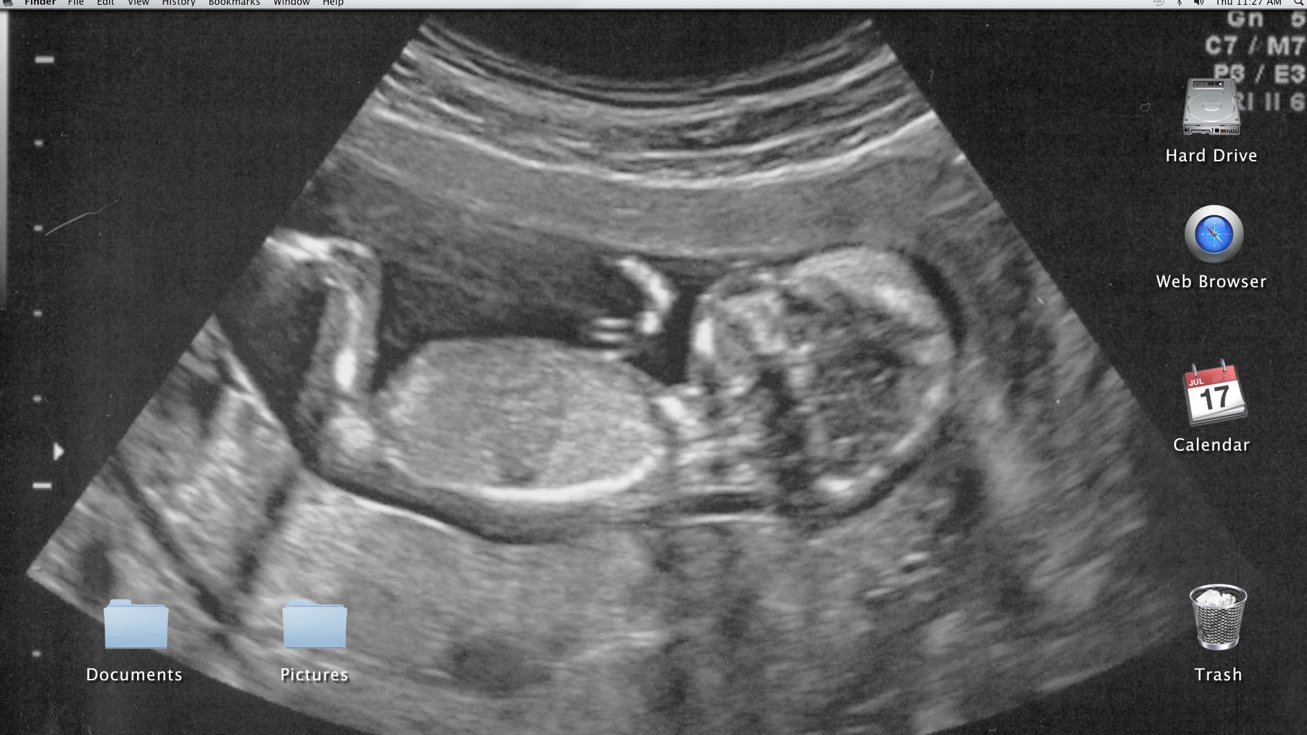 Ultrasound image set as computer desktop wallpaper, with icons for hard drive, web browser, calendar, and folders.
